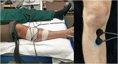 In vivo Measurement of Intraosseous Vascular Haemodynamic Markers in Human Bone Tissue Utilising Near Infrared Spectroscopy